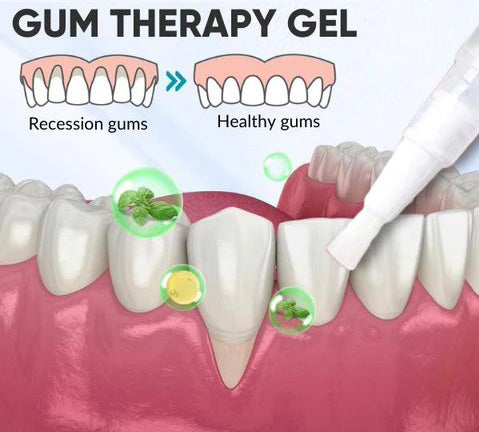 Gum Therapy Gel