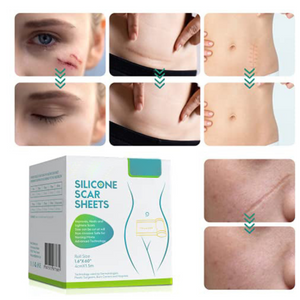 Medical Soft Silicone Gel Tape for Scar Removal