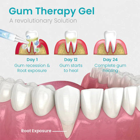 Gum Shield Therapy Gel