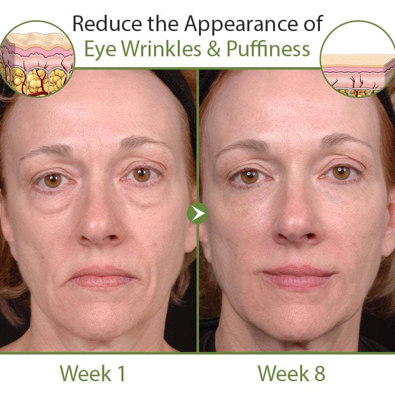 30 Day Anti-Aging Treatment Mask - Botox Face Serum Mask