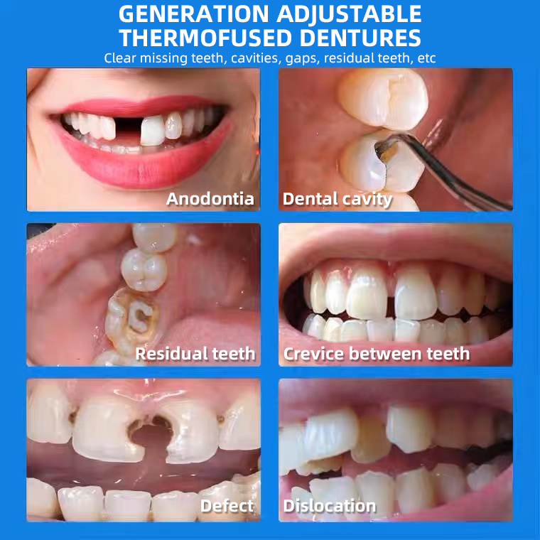 Thermoformed dentures